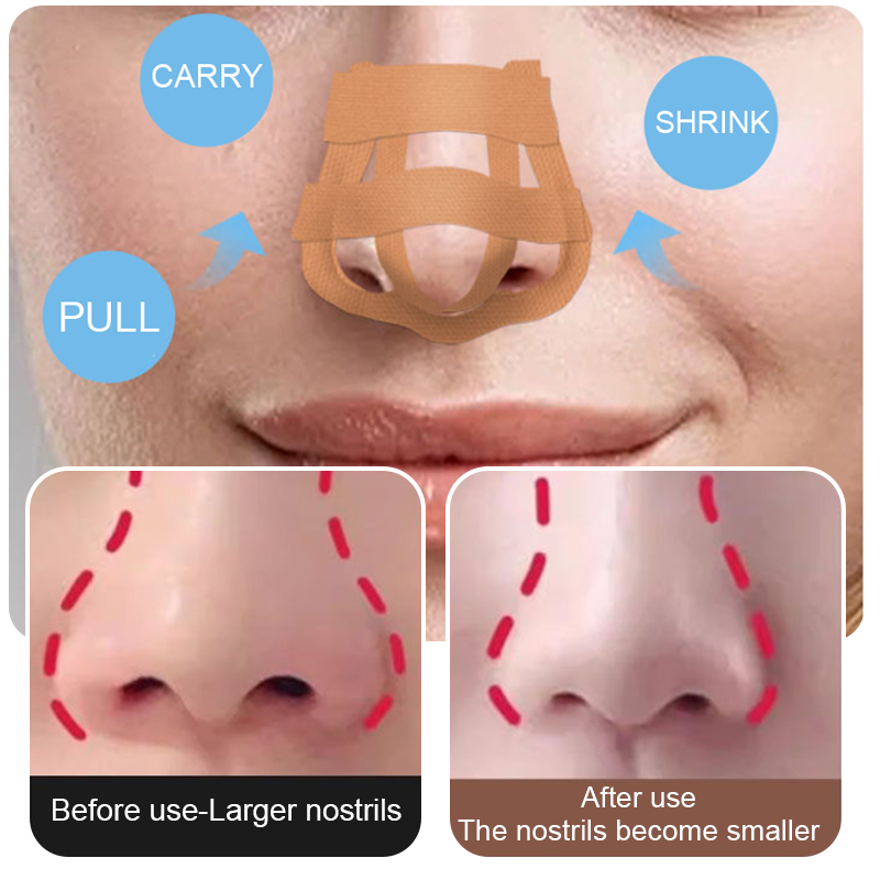Beauty Nose Up Lifting Bridge  - огляд і ціна Nose Trimmer